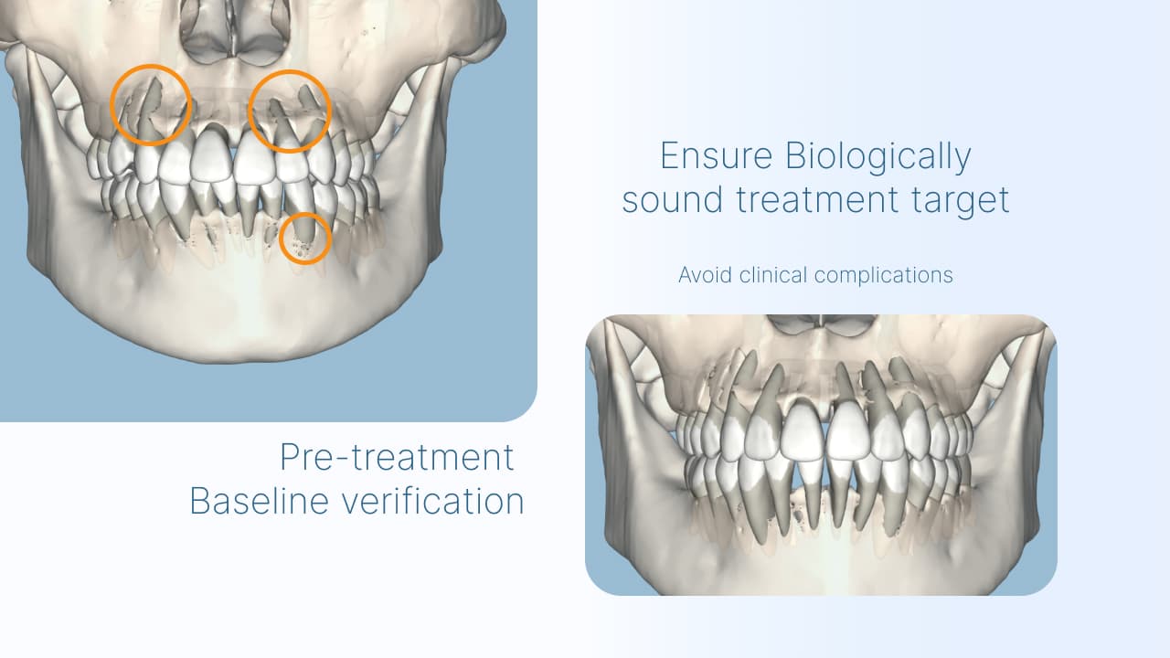 Bone and root visualization for safety planning